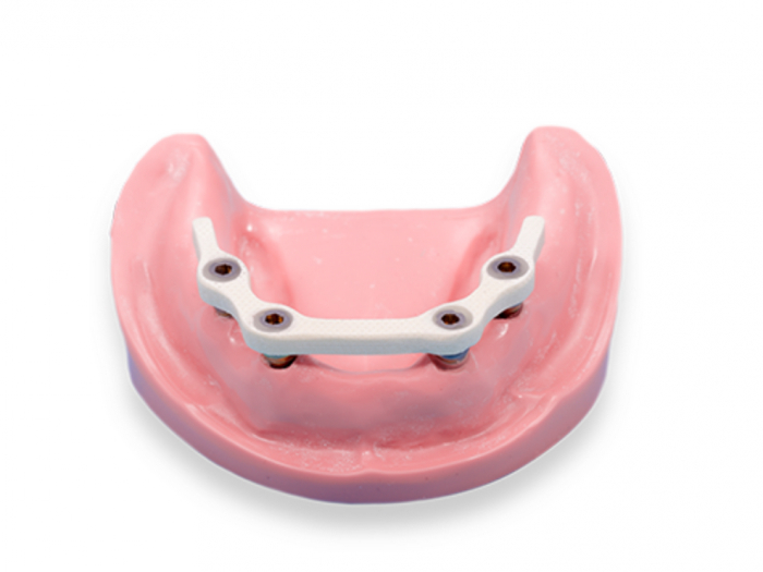 Arc Trilor 3.5 mm [2]