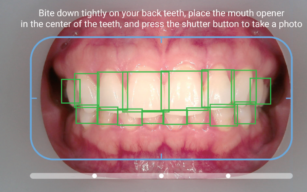 Camera AI intraorala pentru monitorizare dentara - Bundle cu tableta inclusa [4]