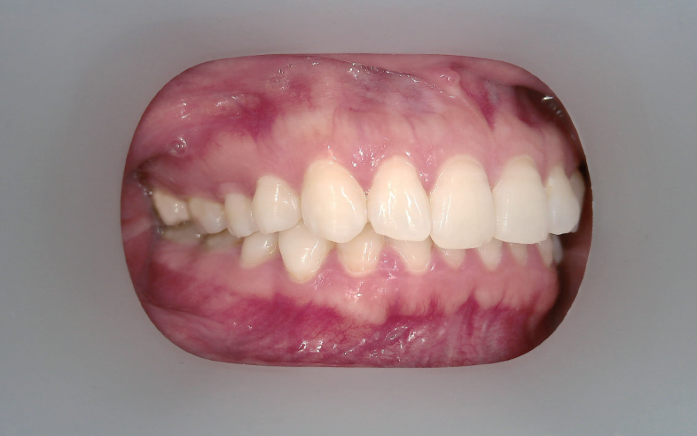 Camera AI intraorala pentru monitorizare dentara - Bundle cu tableta inclusa [3]