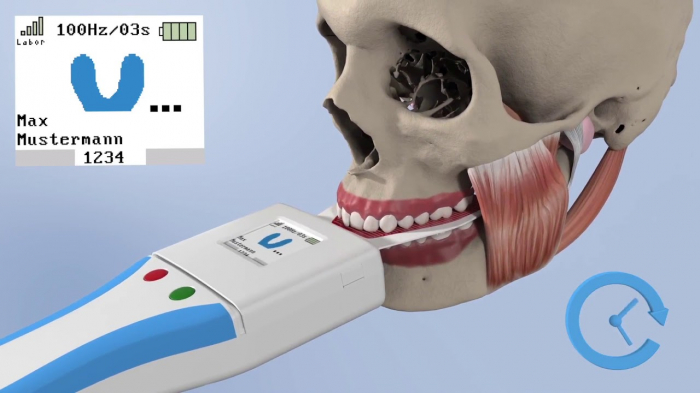 Dispozitiv inregistrare presiune ocluzala OccluSense Bausch [4]