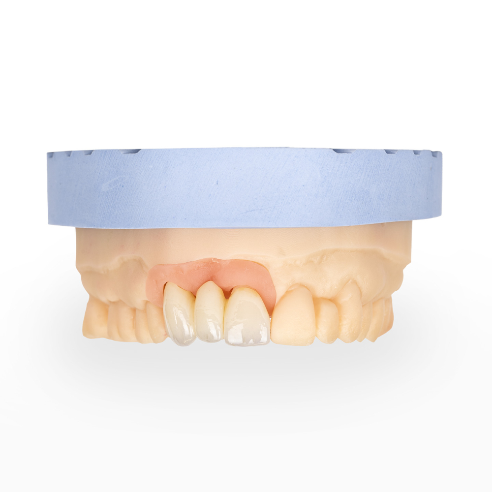 Glazură cu Silicat de Litiu pentru Ceramică Dentară - LiSi LOW FUSE [3]
