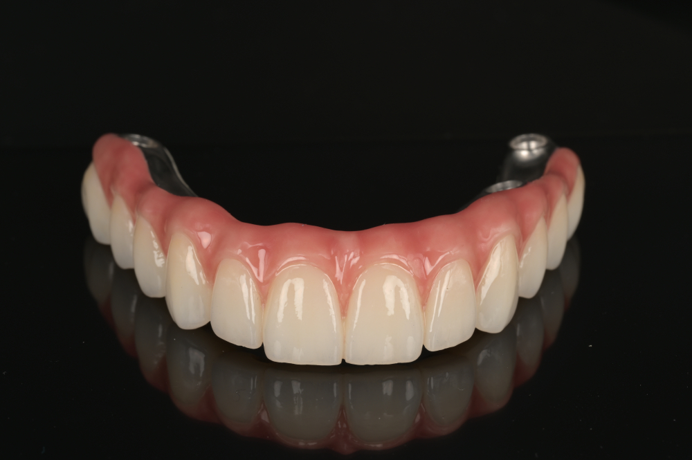 Lucrare Dentara Titan + Zirconiu OneHT (All on 6) [2]