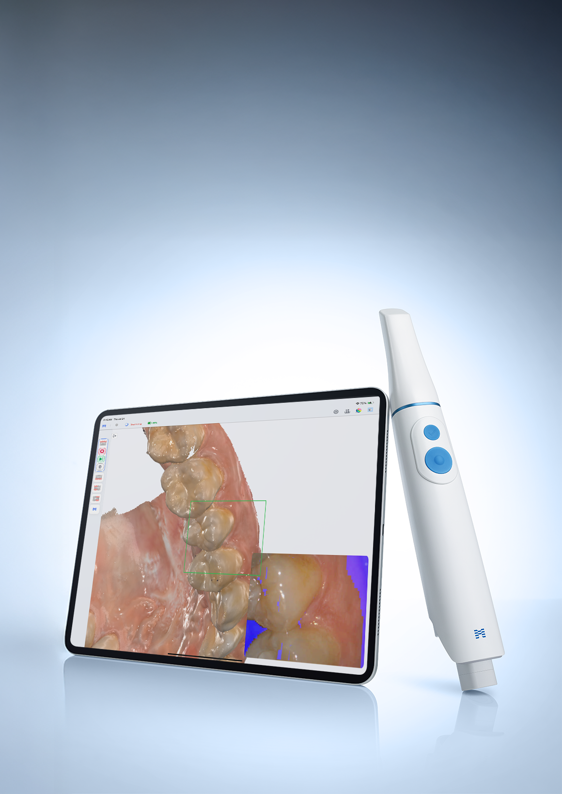 MEDIT i900 Mobility (i900M) – scanner intraoral wireless, cu mobilitate reală [4]