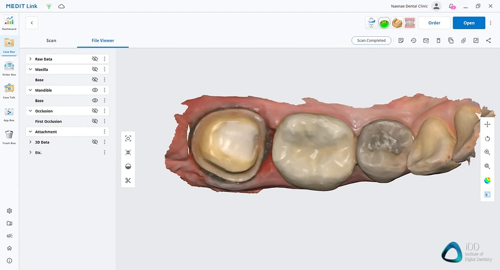 Scanner intraoral Medit i700 [3]