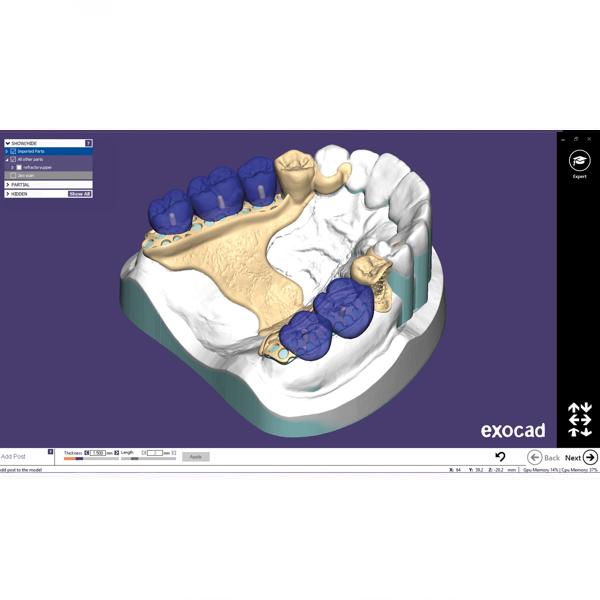 Modul Add-on Exocad (diverse) [1]