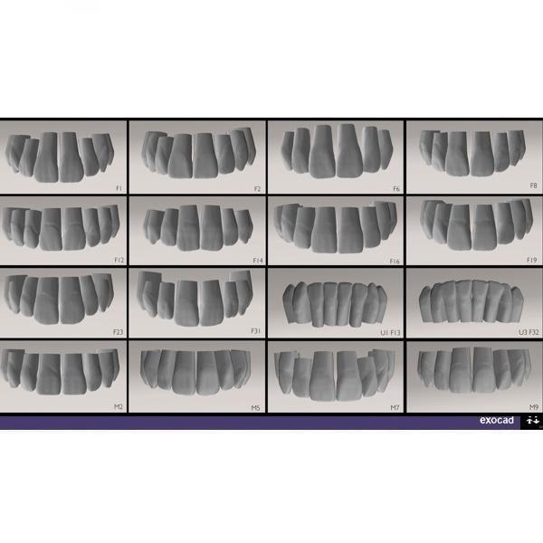 Modul Add-on Exocad (diverse) [1]