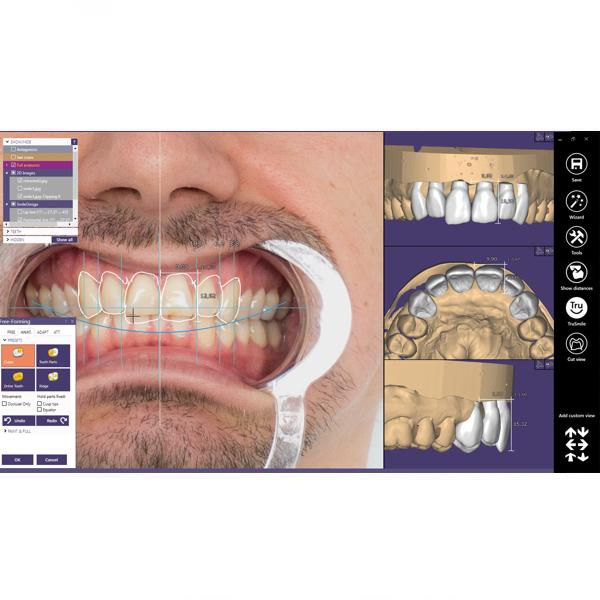 Modul Add-on Exocad (diverse) [1]