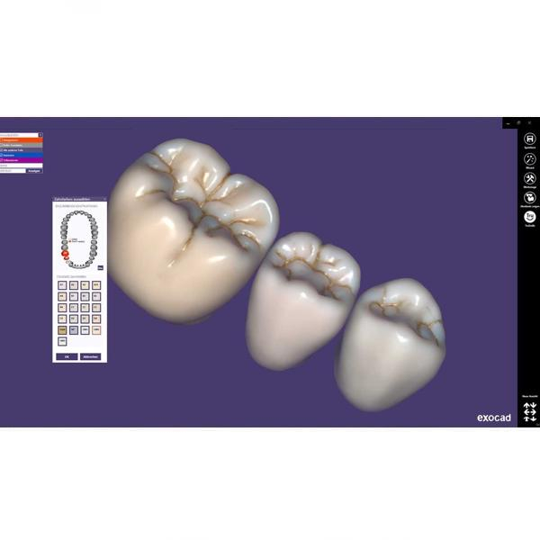 Modul Add-on Exocad (diverse) [1]