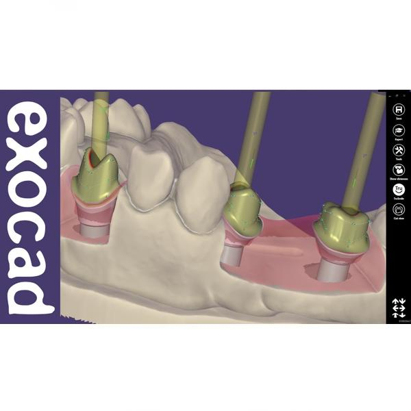 Modul Add-on Exocad (diverse) [1]