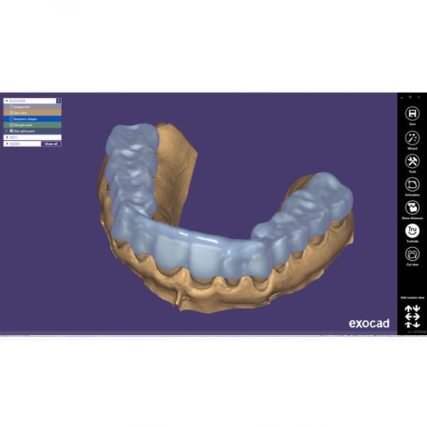 Modul Add-on Exocad (diverse) [1]