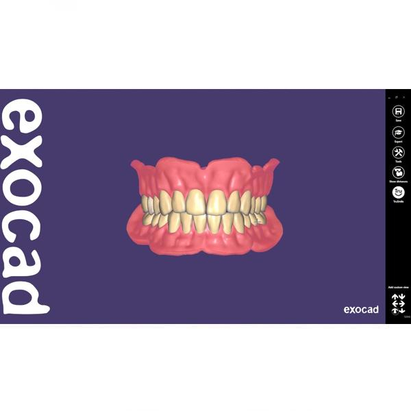 Modul Add-on Exocad (diverse) [1]