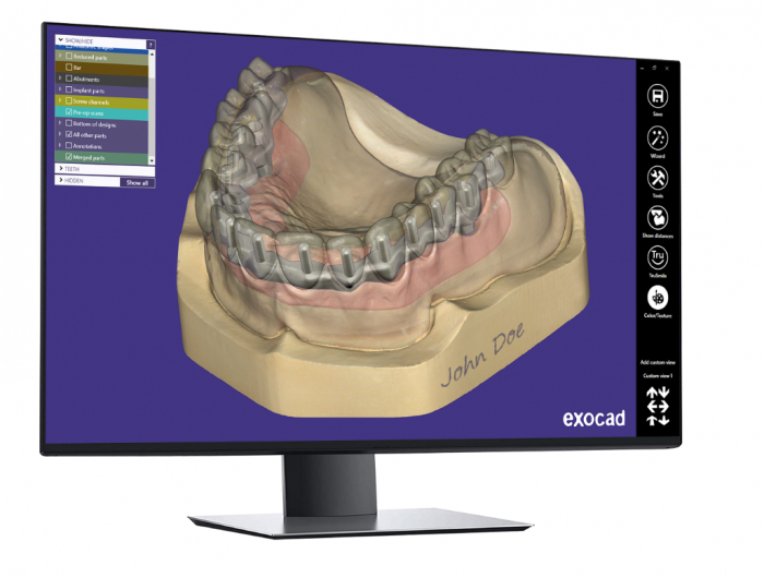 Program Exocad Ultimate Lab Bundle CAD-CAM [3]