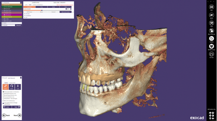 Program Exocad Ultimate Lab Bundle CAD-CAM [4]