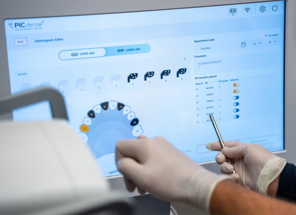 Scanare PIC Dental pentru All-on-4/6 (Fotogrametrie Digitala) [6]