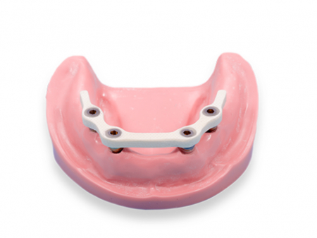 Arc Trilor 3.5 mm [1]