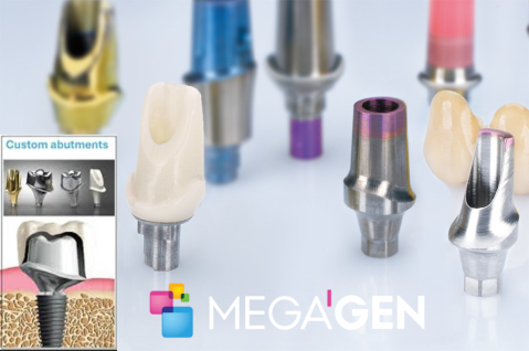 Bonturi Protetice - Bont Protetic Personalizat Megagen (Premill)