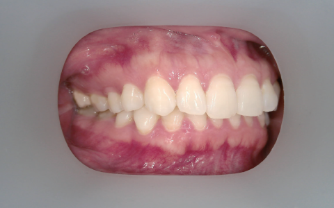 Camera AI intraorala pentru monitorizare dentara - Bundle cu tableta inclusa [2]