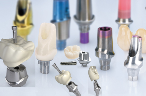 Full Anatomic - Element dentar Compozit Cu Bont Protetic Personalizat