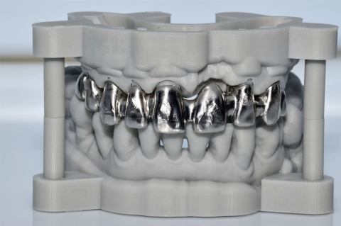 Anatomie redusa - Element dentar Crom Cobalt Frezat