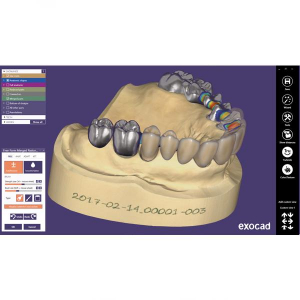 Program Exocad Basic CAD-CAM [1]