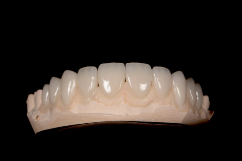 Fatete - Fateta Compozit