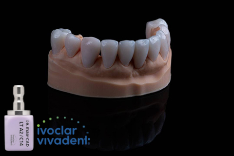 Fatete - Fateta E.MAX