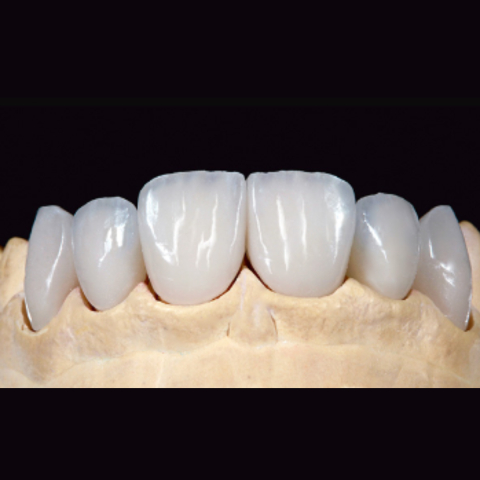 Fatete - Fateta Zirconiu OneSmile