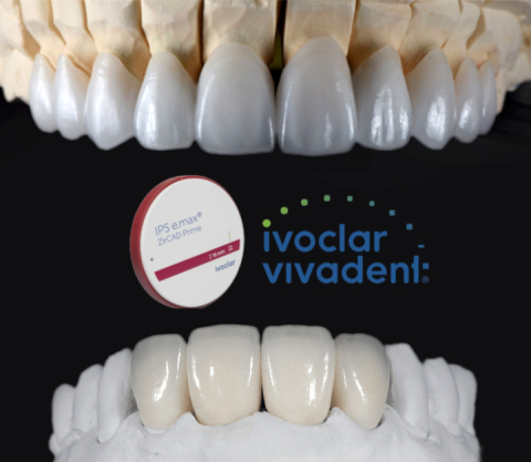 Fatete - Fateta Zirconiu Stratificat Ivoclar Prime