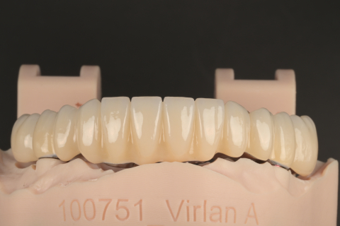 Lucrare Dentara Titan + Zirconiu 3D Ivoclar PRIME (All on 6) [1]