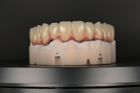 Protetica - Lucrare Dentara Titan + Zirconiu OneHT (All on 6)