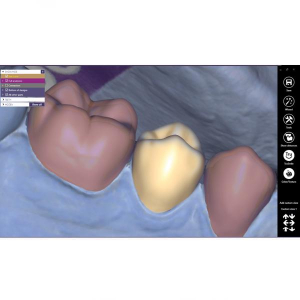 Modul Add-on Exocad (diverse)