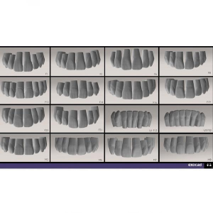 Modul Add-on Exocad (diverse)