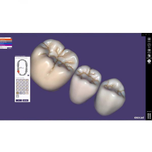 Modul Add-on Exocad (diverse)