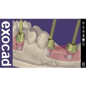 Modul Add-on Exocad (diverse)