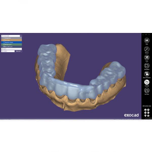 Modul Add-on Exocad (diverse)