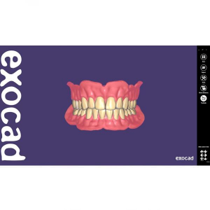 Modul Add-on Exocad (diverse)