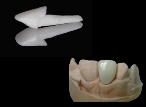 DCR + Full Anatomic - Pivot Zirconiu Opak + Element dentar PMMA