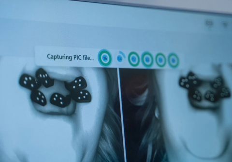 Scanare PIC Dental pentru All-on-4/6 (Fotogrametrie Digitala) [6]