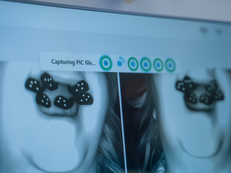 Scanner Extraoral Pic System [2]