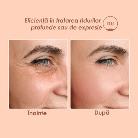 Balsam Facial Antirid cu Efect de Lifting DEROL - NU ACTIVA!!! INTERZIS [4]