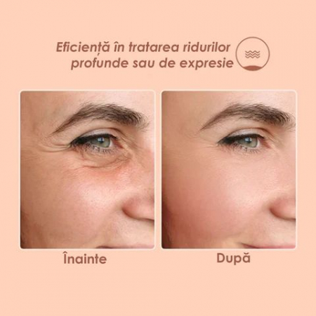 Balsam Facial Antirid cu Efect de Lifting DEROL - NU ACTIVA!!! INTERZIS [3]