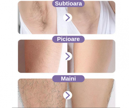 Cristal Hair - depilator [1]