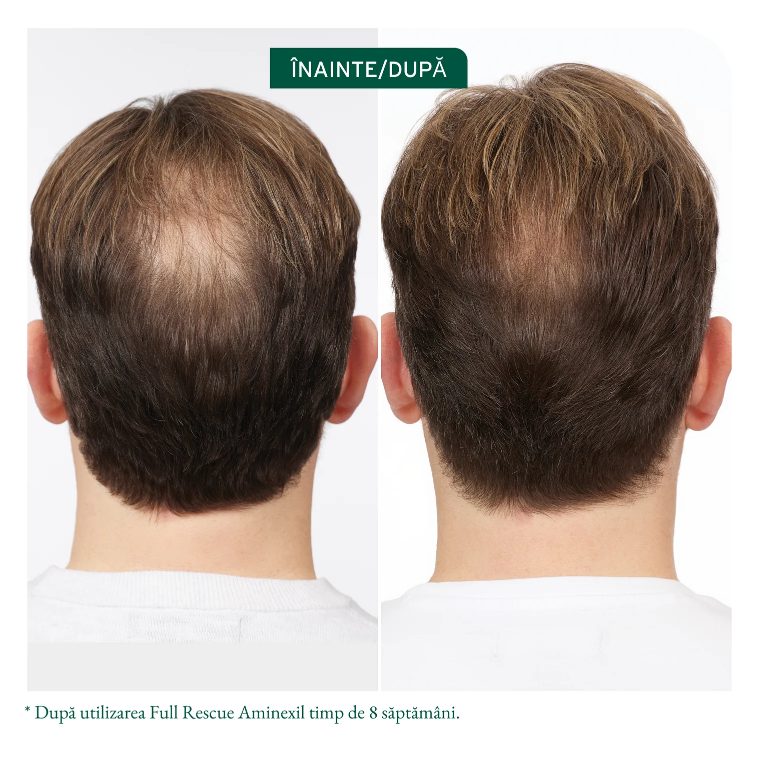 Fiole Biolage Full Rescue Tratament Leave-In cu Aminexil, Ulei de Rozmarin și Niacinamide – 6x10ml [2]