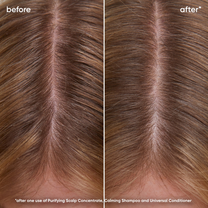 Sampon Biolage Scalp Sync Calmant 250ml [5]