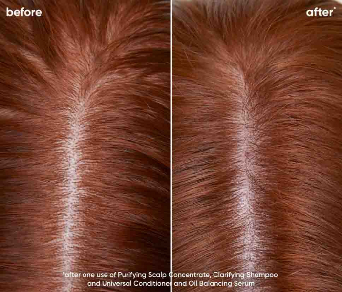 Sampon Biolage Scalp Sync Clarifiant 250ml [4]