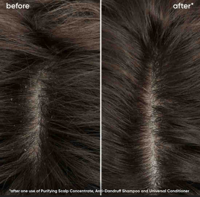 Sampon Biolage Scalp Sync Anti Dandruff 250 ml [3]