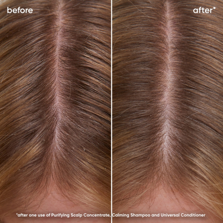Sampon Biolage Scalp Sync Calmant 250ml [4]