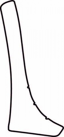 Ornamente - Autocolant protetie aripa spate dreapta transparent, 3M PPF 4.0 folie, ajustare automata potrivit TOYOTA YARIS XP90 5 usi 2005-2010