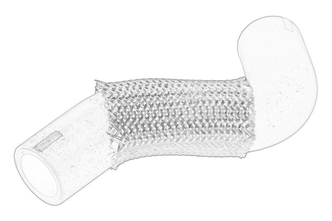 Piese Auto - Furtun epurator potrivit TOYOTA AVENSIS 2.0D/2.2D 04.03-11.08