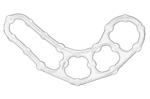 Garnitura capac supape (interior) potrivit OPEL INSIGNIA A, INSIGNIA A COUNTRY, INSIGNIA B, INSIGNIA B COUNTRY, INSIGNIA B GRAND SPORT 2.0 07.08-